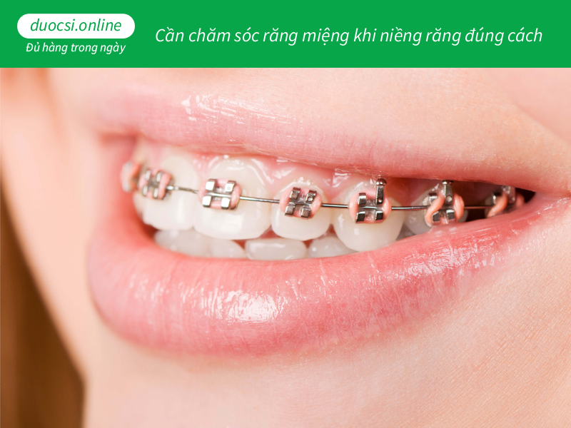 Cần chăm sóc răng miệng khi niềng răng đúng cách