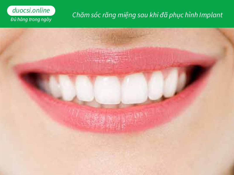 Chăm sóc răng miệng sau khi đã phục hình Implant