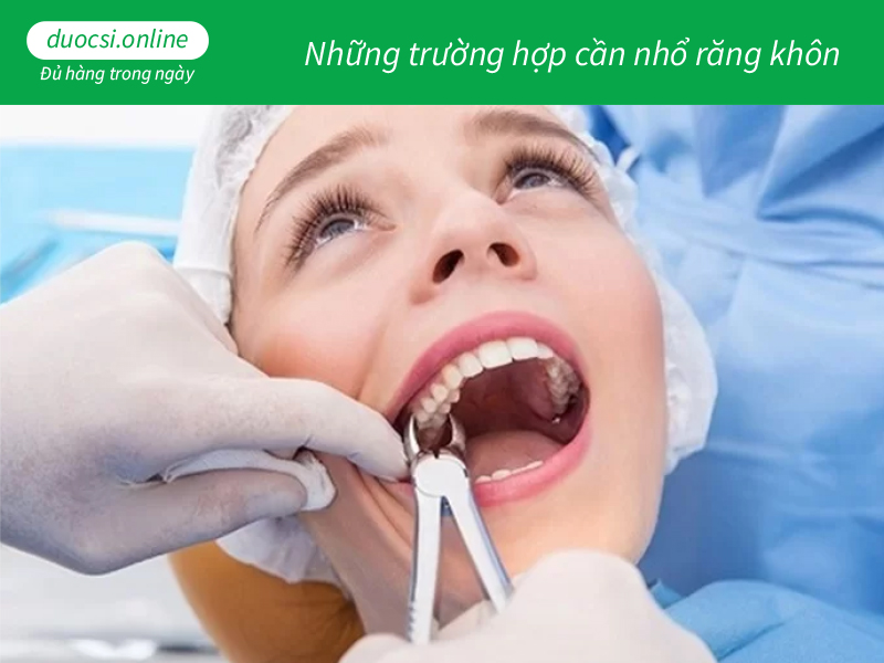 Những trường hợp cần nhổ răng khôn